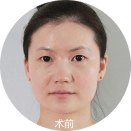 美莱生态美鼻
