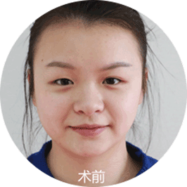 原生佳人弧线鼻