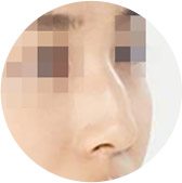 鹰钩鼻
